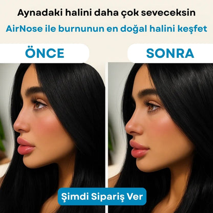 AirNose | Burun Kaldırma Aparatı